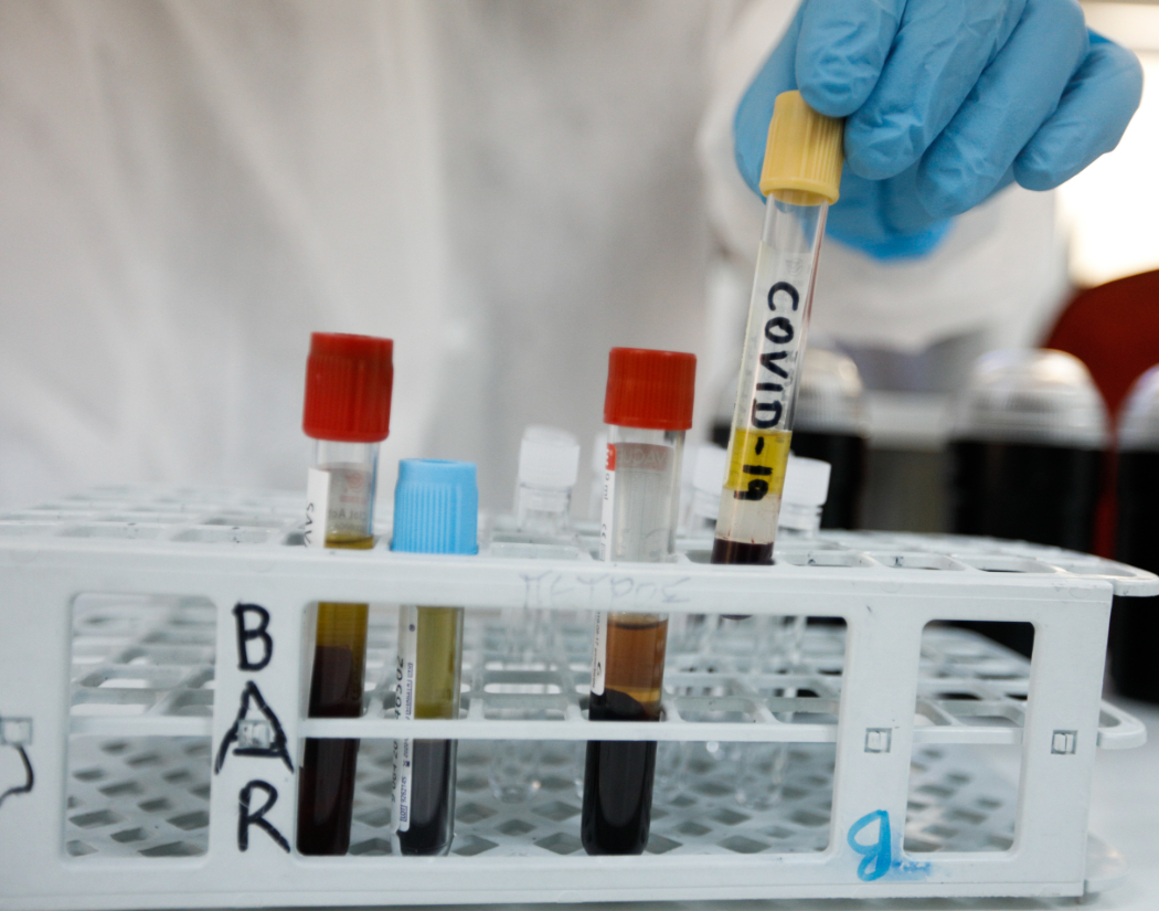 neo-kroysma-koronaioy-se-6xrono-paidi-sti-larisa